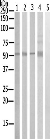 兔抗CSRNP2多克隆抗体