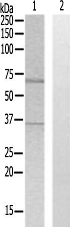 兔抗CSRNP3多克隆抗体