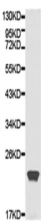 兔抗CSRP1多克隆抗体
