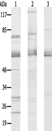 兔抗CSTF2多克隆抗体 
