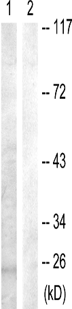 兔抗BAD(Phospho-Ser91/128)多克隆抗体