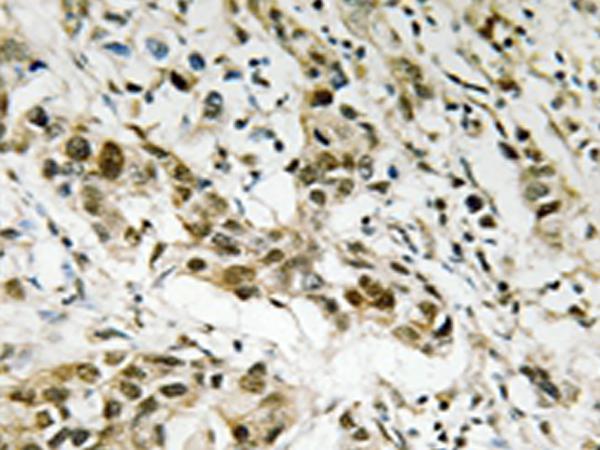 兔抗CTBP1(Ab-422)多克隆抗体 