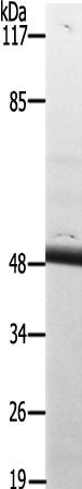 兔抗CTBP1(Ab-422)多克隆抗体 