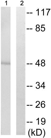 兔抗CTBP1(Phospho-Ser422)多克隆抗体