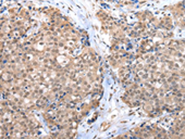 兔抗CTBP1多克隆抗体