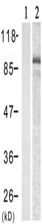 兔抗CTNNB1(Phospho-Ser33)多克隆抗体