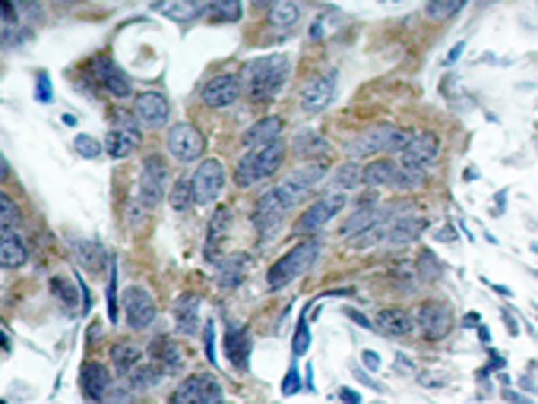 兔抗CTNNB1(Phospho-Ser33)多克隆抗体