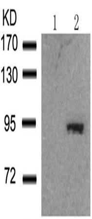 兔抗CTNNB1(Phospho-Ser37)多克隆抗体