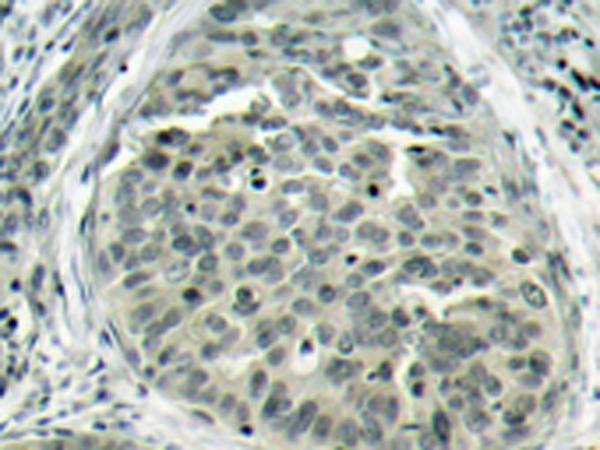 兔抗CTNNB1(Phospho-Ser37)多克隆抗体