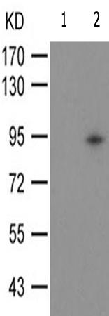 兔抗CTNNB1(Phospho-Tyr489)多克隆抗体 