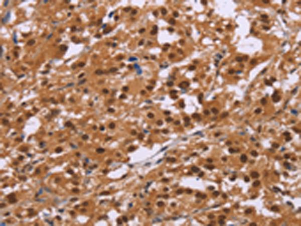 兔抗CTNNBL1多克隆抗体