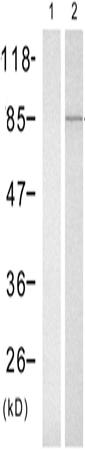 兔抗CTTN(Phospho-Tyr466)多克隆抗体