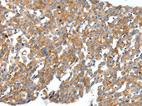 兔抗CXCL12多克隆抗体