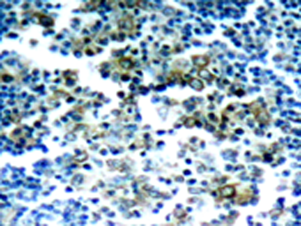 兔抗BCR(Phospho-Tyr177)多克隆抗体