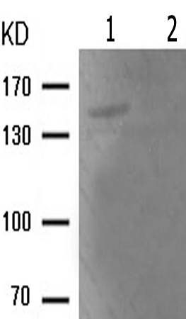 兔抗BCR(Phospho-Tyr360)多克隆抗体