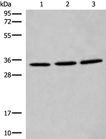 兔抗CYB5R1多克隆抗体