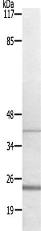 兔抗CYB561D2多克隆抗体