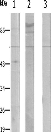 兔抗CYP1A1/2多克隆抗体