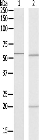 兔抗CYP2A7多克隆抗体