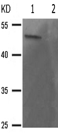 兔抗BLNK(Phospho-Tyr96)多克隆抗体