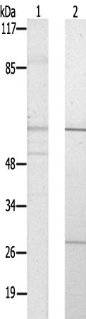 兔抗CYP2U1多克隆抗体