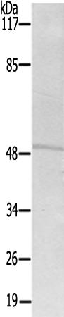 兔抗CYP3A7多克隆抗体