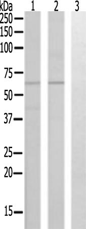 兔抗CYP4X1多克隆抗体