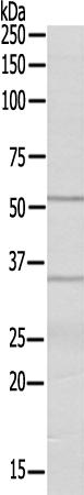 兔抗CYP20A1多克隆抗体