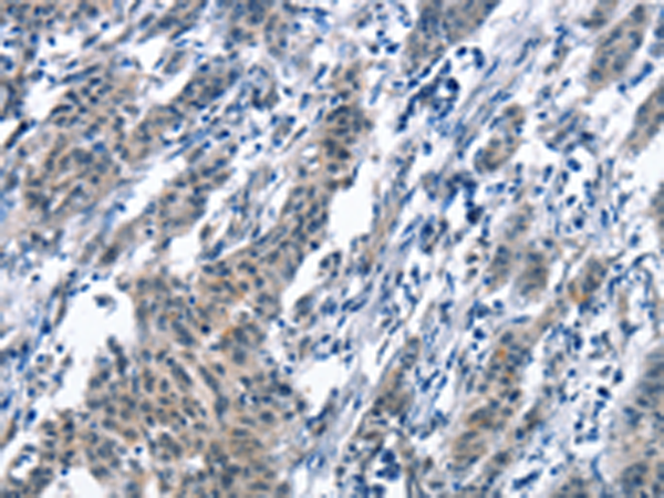 兔抗BNIP3L多克隆抗体