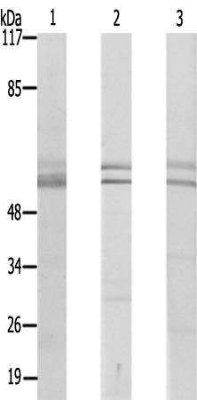 兔抗CYP26A1多克隆抗体
