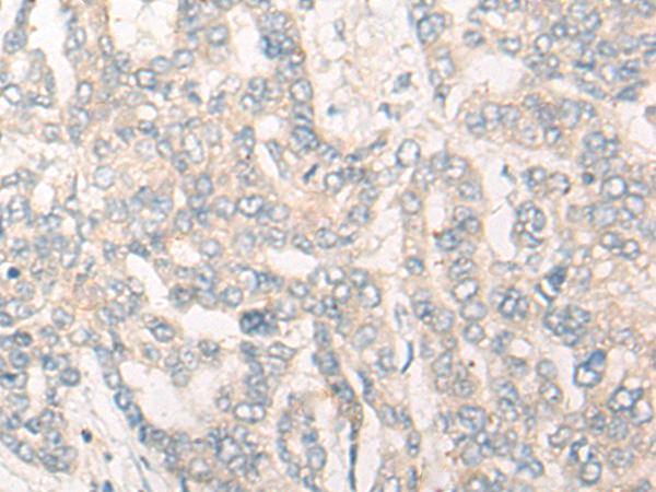 兔抗CYP26B1多克隆抗体