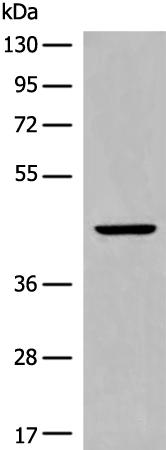兔抗CYSLTR2多克隆抗体 