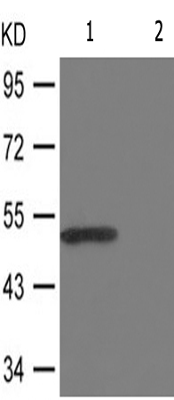 兔抗CAMK2B/G/D(Phospho-Thr287)多克隆抗体
