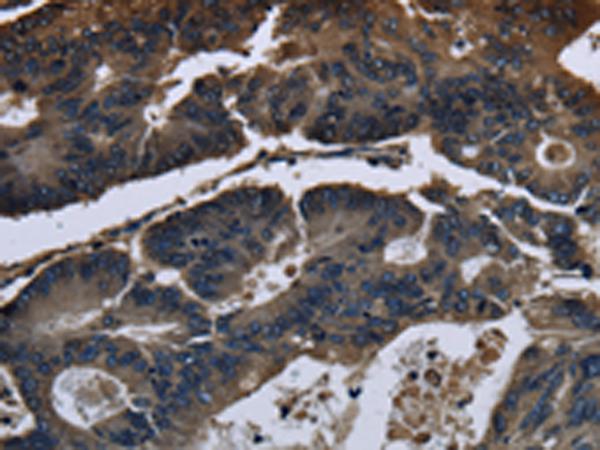 兔抗DHCR7多克隆抗体 