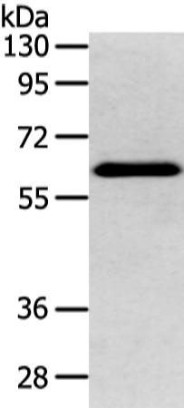 兔抗DHCR24多克隆抗体