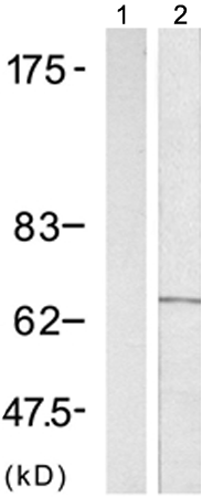 兔抗CARM1(Phospho-Ser228)多克隆抗体