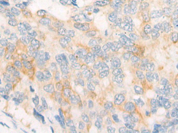 兔抗DLEC1多克隆抗体