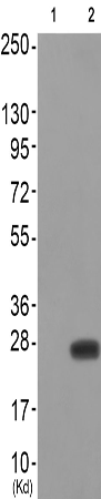 兔抗CAV2(Phospho-Tyr27)多克隆抗体