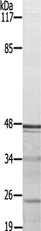 兔抗CBX5(Ab-92)多克隆抗体