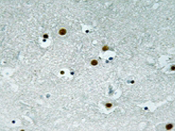 兔抗CBX5(Ab-92)多克隆抗体