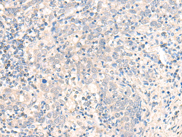 兔抗CCDC47多克隆抗体