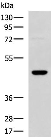 兔抗DNAJA4多克隆抗体