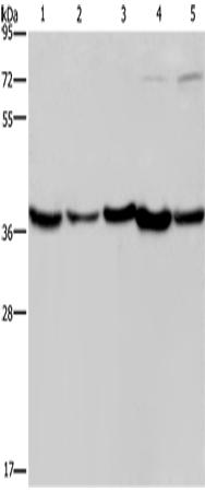 兔抗DNAJB4多克隆抗体