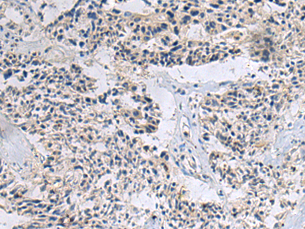 兔抗CCL22多克隆抗体