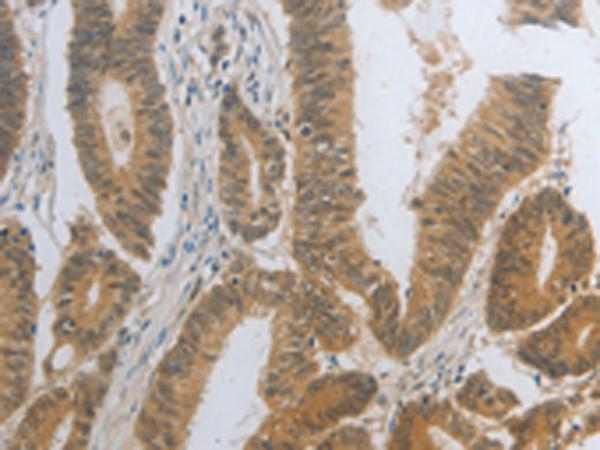 兔抗DNAJC7多克隆抗体