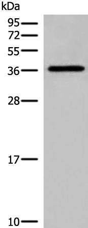 兔抗DNAJC9多克隆抗体