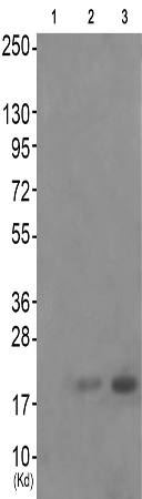 兔抗CD247(Phospho-Tyr142)多克隆抗体