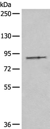 兔抗DTX3L多克隆抗体