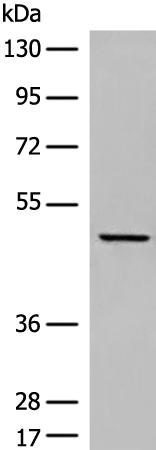 兔抗DUSP5多克隆抗体