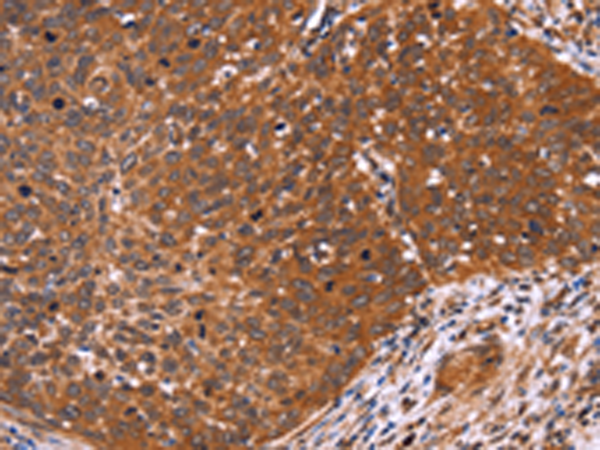 兔抗CDC37L1多克隆抗体